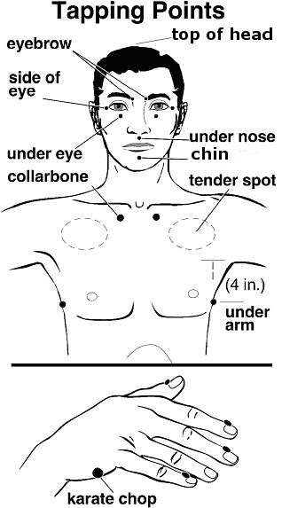 Acutapping - EFT