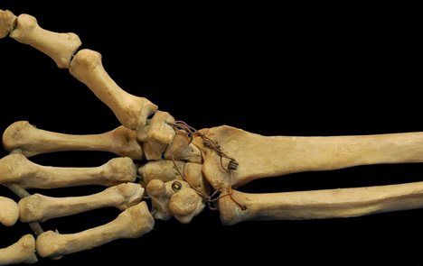Home test for bone density
